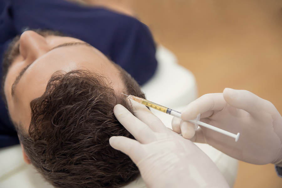man receiving PRP hair loss injections